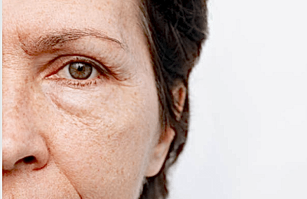 Отёки на лице