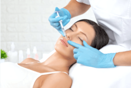 Носогубные складки