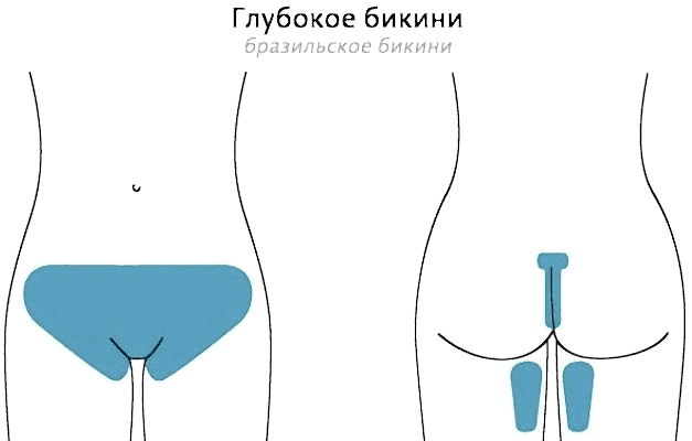 Глубокое бикини.png