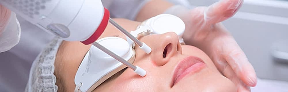 Сосудистые звёздочки