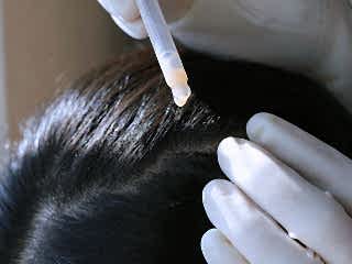 Лечение волос