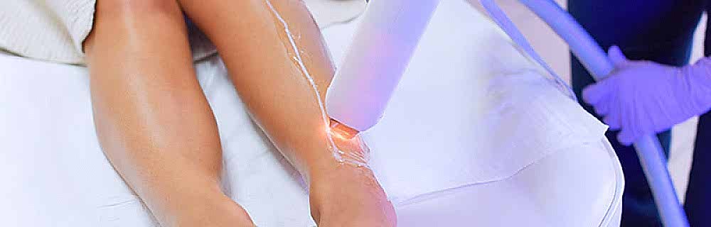 Фотоэпиляция