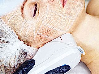 СМАС лифтинг