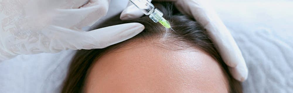 Мезотерапия для волос