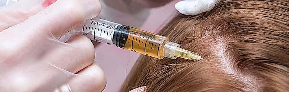 Плазмолифтинг волос