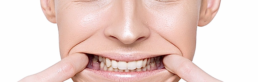 Буккальный массаж лица