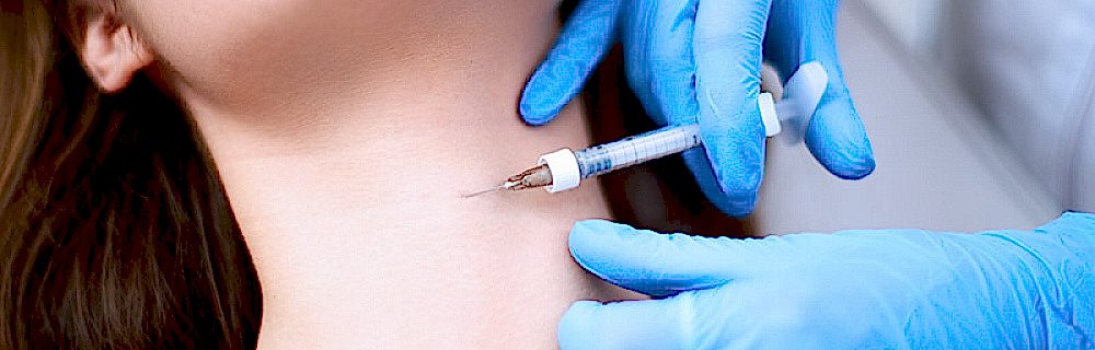 Кольца Венеры