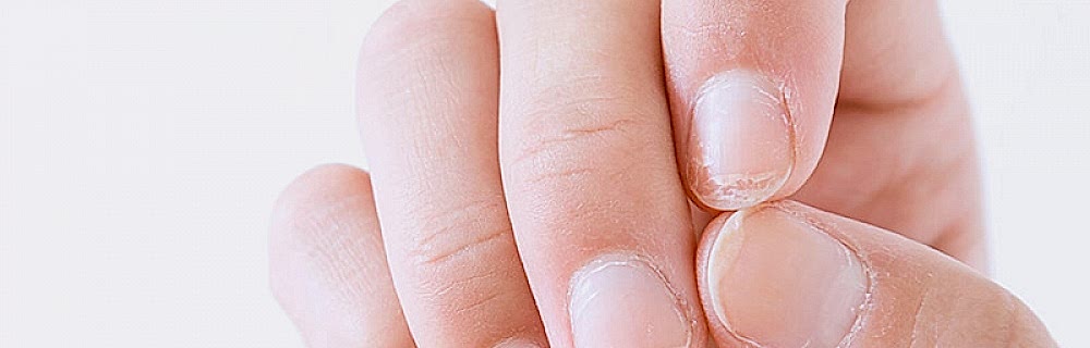 Лечение ногтей лазером