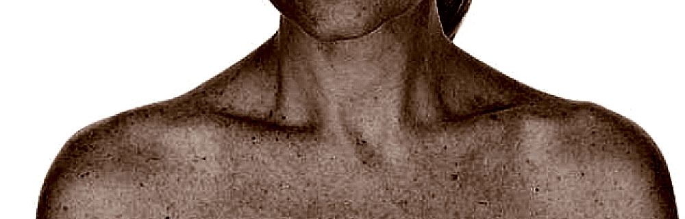 Пигментные пятна